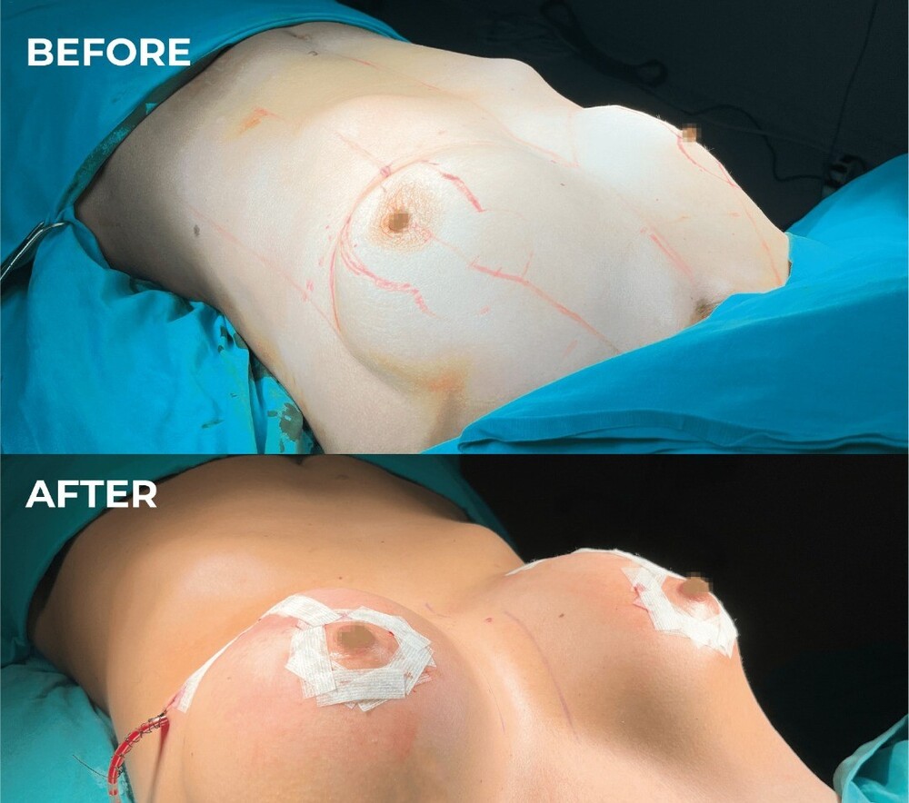 Before and After Result